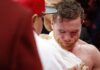 ‘Canelo’ se someterá a cirugía en una mano, pues peleó lesionado ante Golovkin: “Soy un guerrero”