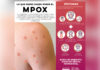 Salud Sonora confirma dos casos importados de MPOX; ambas personas no necesitaron hospitalización